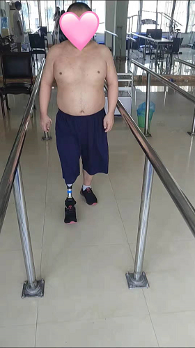 奧索2000關節+暴風系列腳板