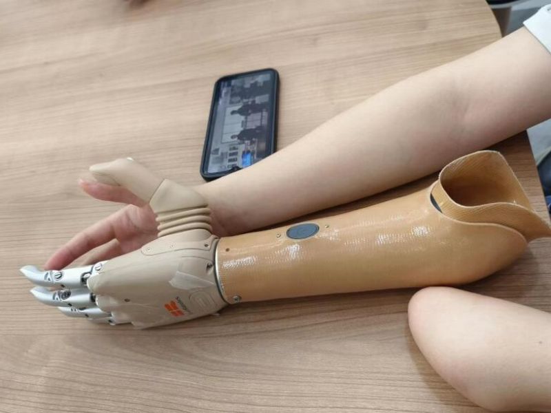 兩通道智能仿生手案例