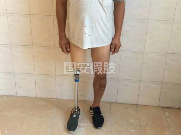 長沙國安假肢康復用品有限公司,長沙假肢用品,國安假肢康復用品,假肢矯形器,康復器材,假肢配件,矯形器支具
