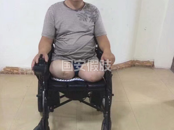 長沙國安假肢康復用品有限公司,長沙假肢用品,國安假肢康復用品,假肢矯形器,康復器材,假肢配件,矯形器支具
